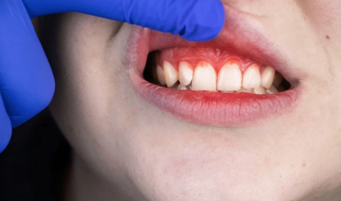 Hidden Signs Your Gums Are Unhealthy (Even When Teeth Look Fine)