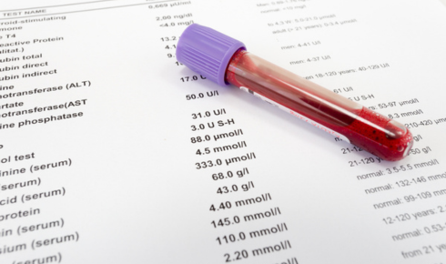 Understanding Your Blood Test Report: Basics for Non-Medical People